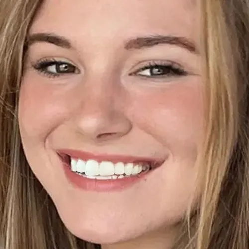 Sonrisa de adolescente antes del tratamiento de ortodoncia