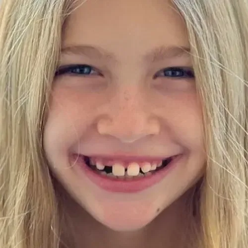 Sonrisa de niña antes del tratamiento de ortodoncia