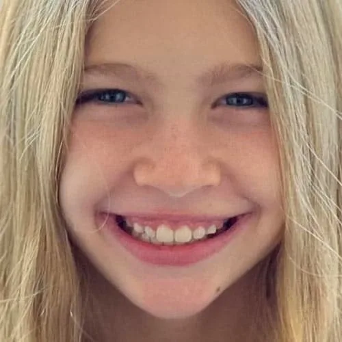 Sonrisa de niña después del tratamiento de ortodoncia