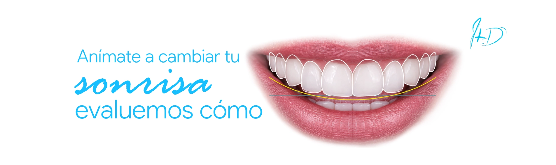 Anímate a cambiar tu sonrisa, evaluemos cómo — Ivaskevich Design Odontología, Encarnación